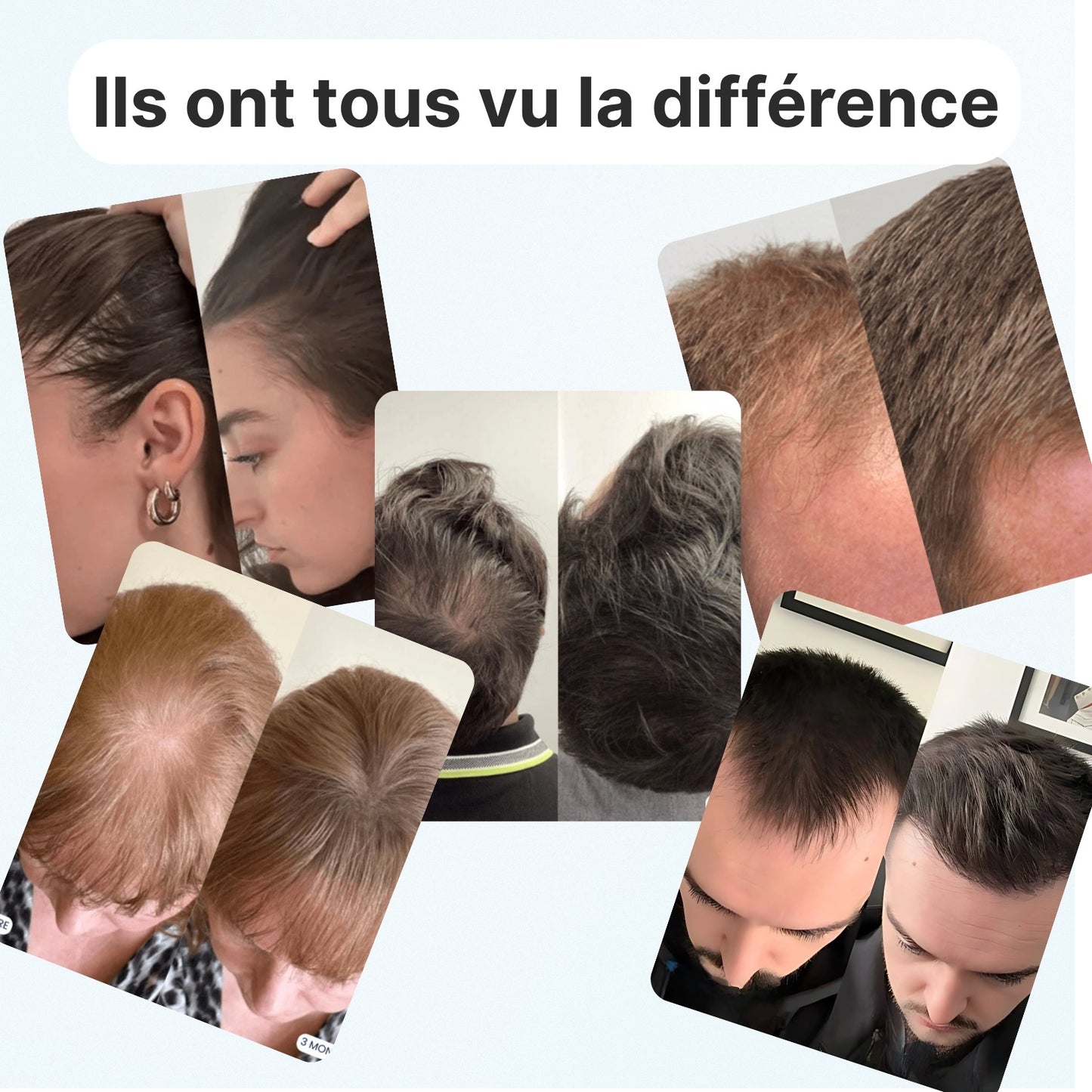 Soin Capillaire Ciblé Florea